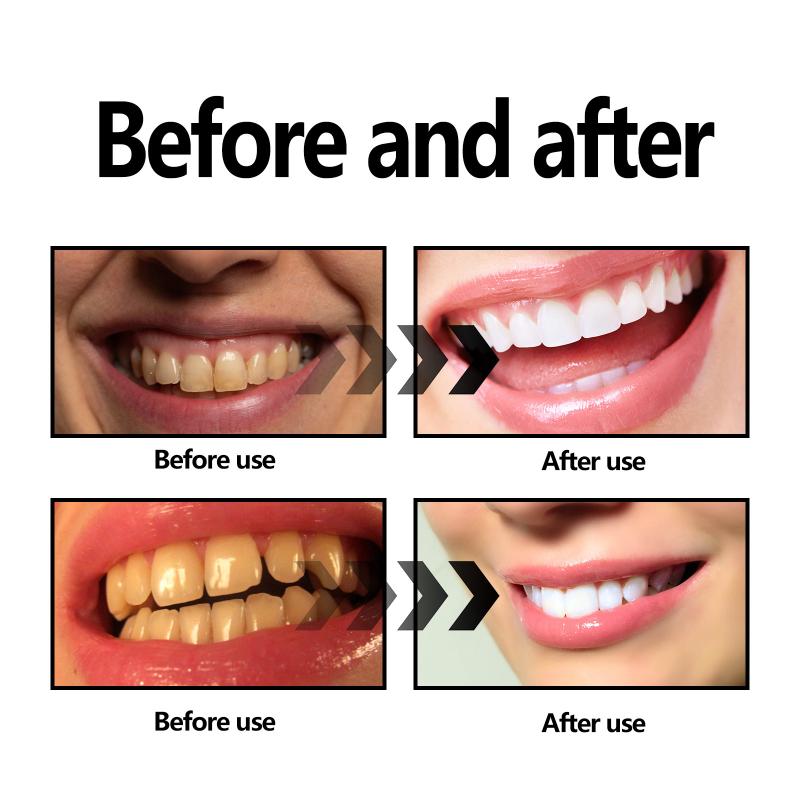 Teeth Whitening Powder Charcoa - Whitening Teeth Using Baking Soda review and price