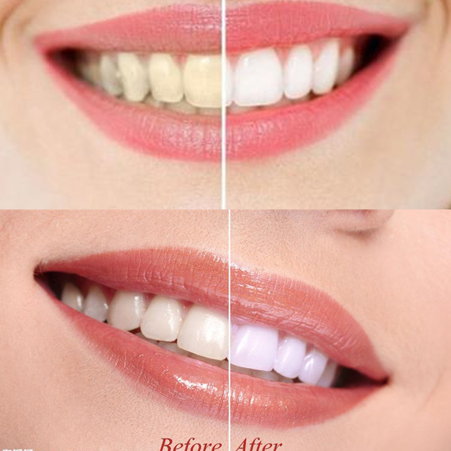 Bamboo Charcoal Teeth Tooth De - Teeth Whitening App review and price