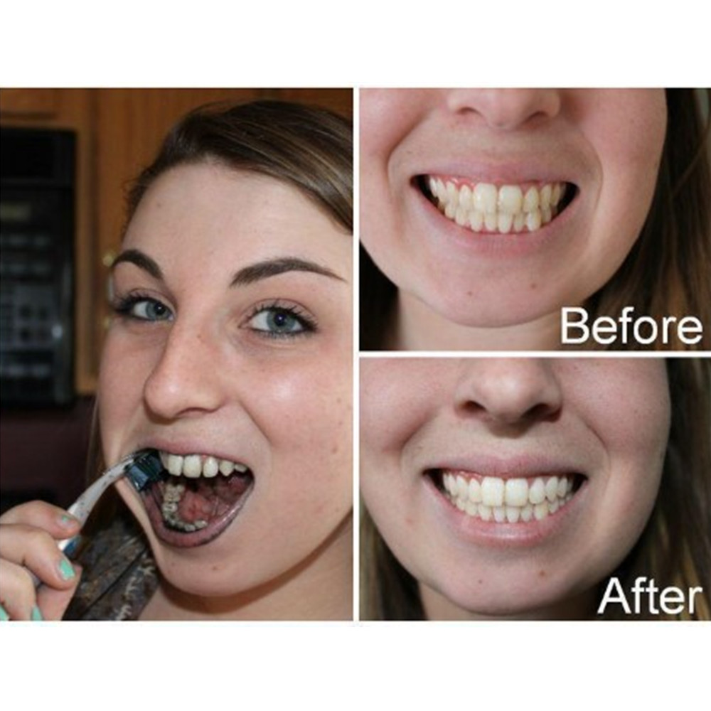 Bamboo Charcoal Teeth Tooth De - Teeth Whitening App review and price
