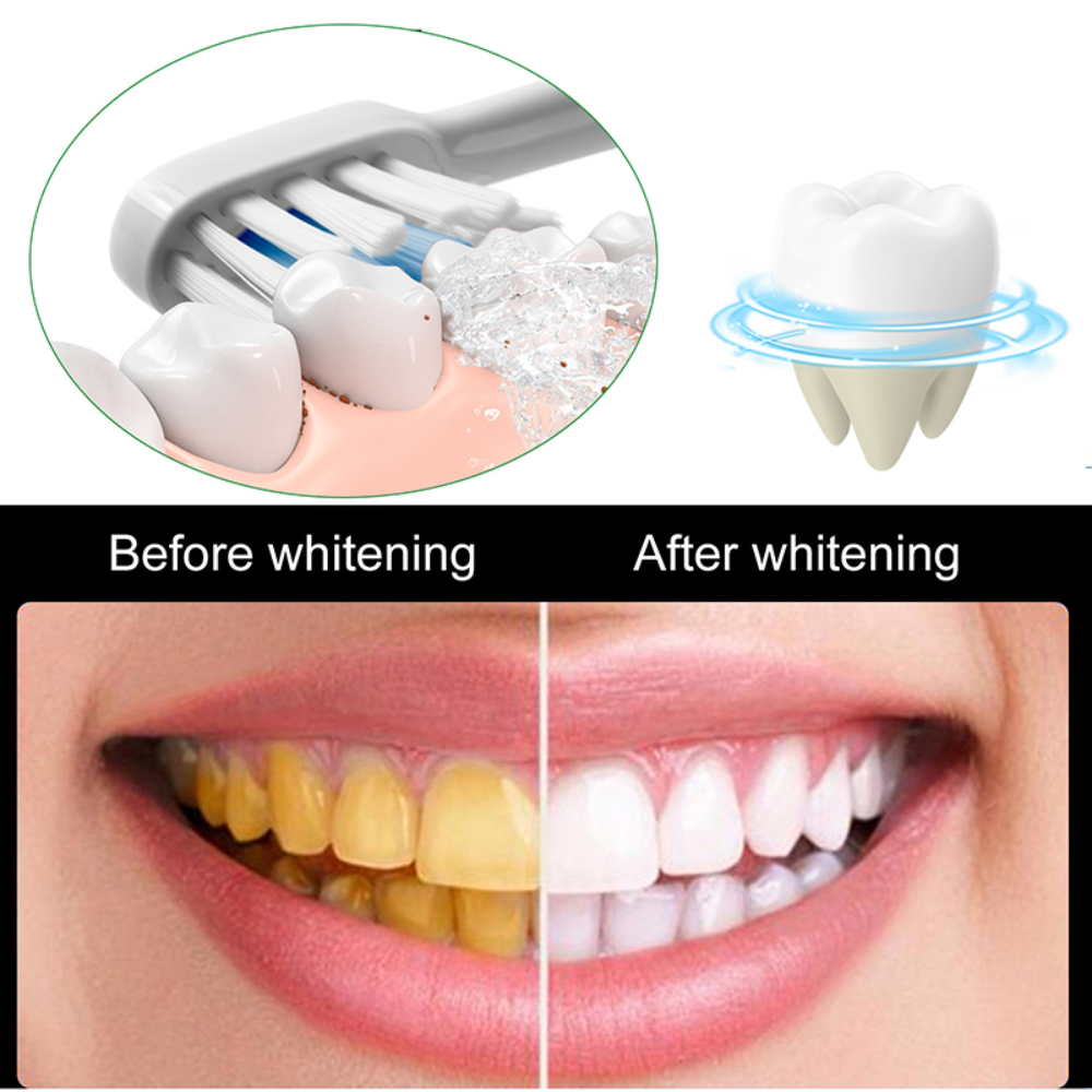 Useful Toothpaste Prevent And  - Whitening Teeth Using Baking Soda review and price