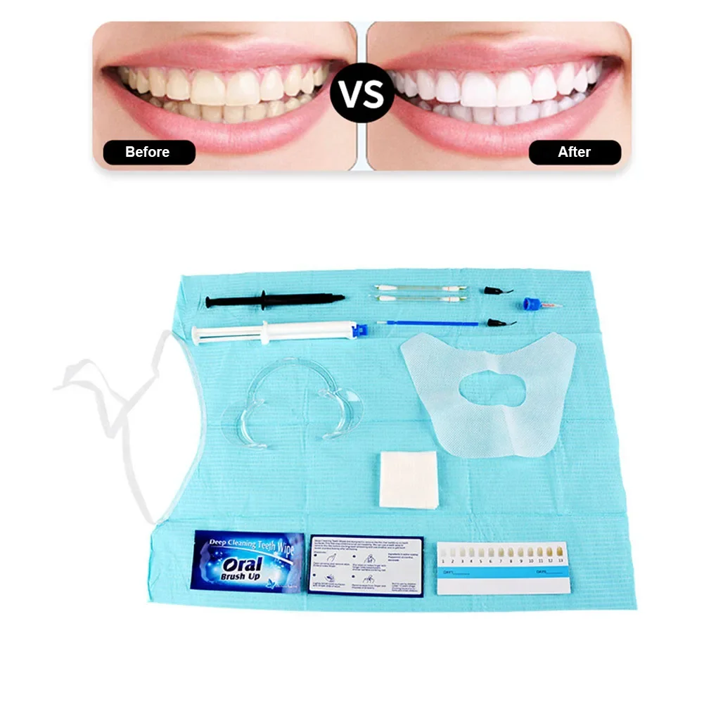 Dentist Clinic Teeth Whitening - Teeth Whitening With Hydrogen Peroxide review and price