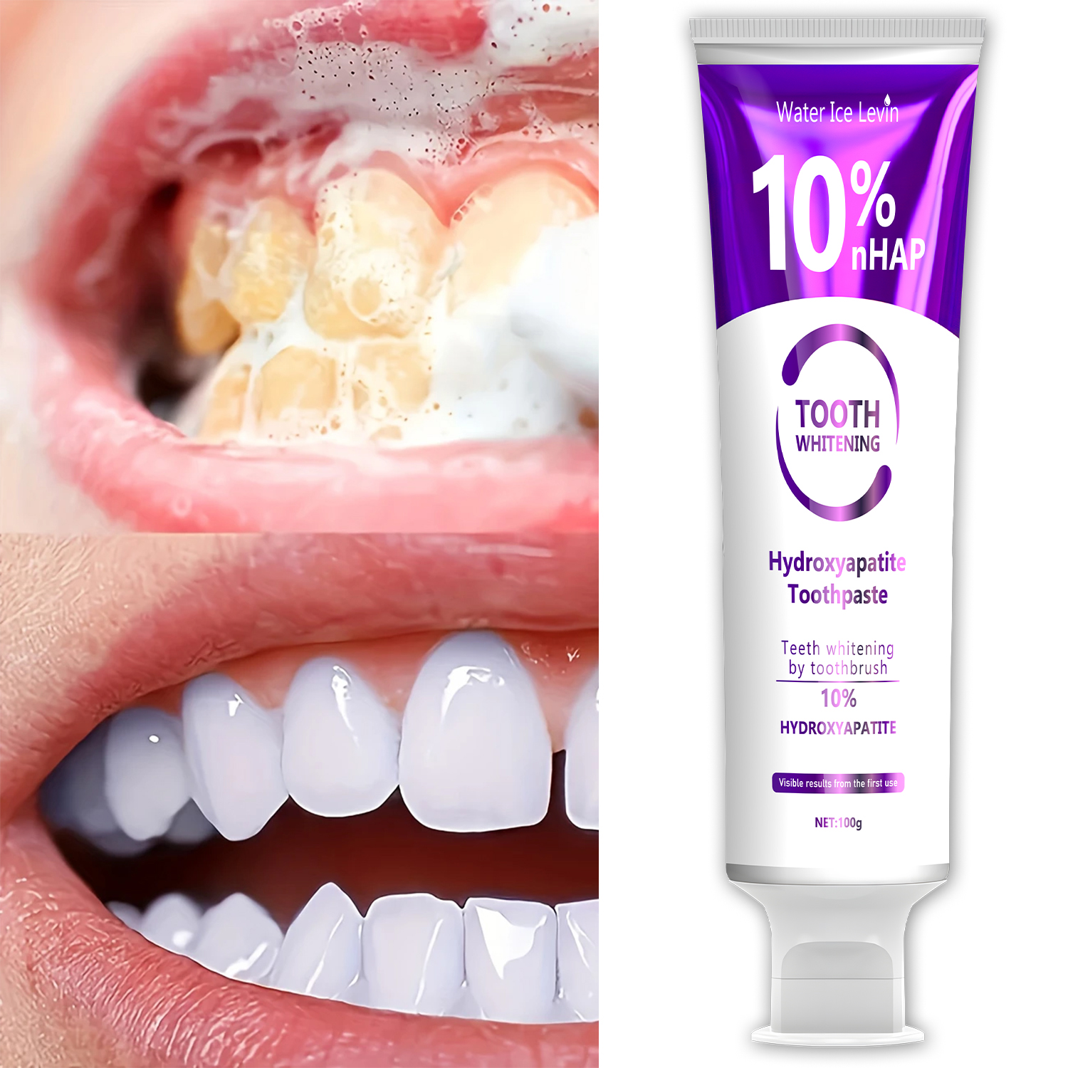 10% Nanoh Hydrogen Oxide Tooth - Teeth Whitening With Hydrogen Peroxide review and price
