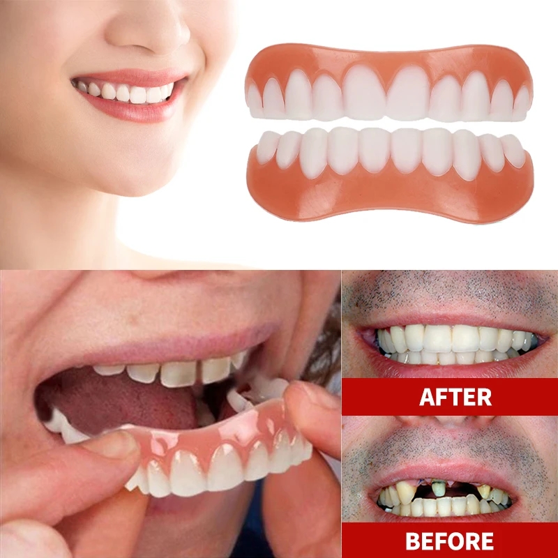 New Denture Silicone Kit Dentu - Teeth Whitening With Braces review and price