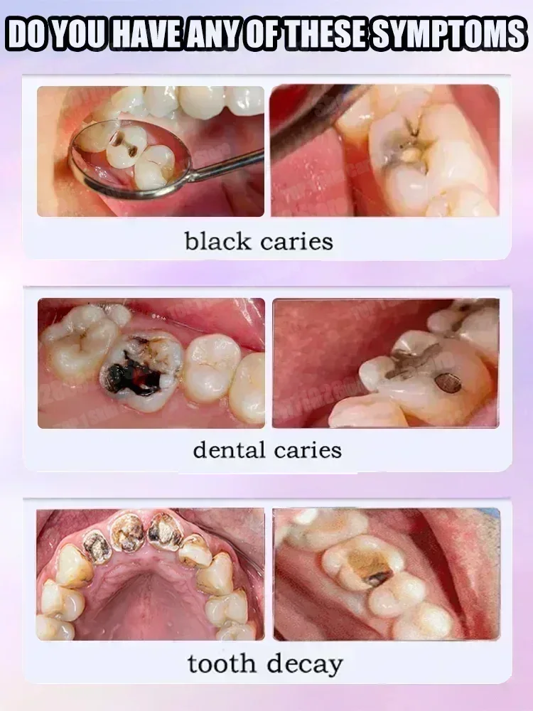Hot sales Best-selling, Scient - Teeth Whitening Cream review and price