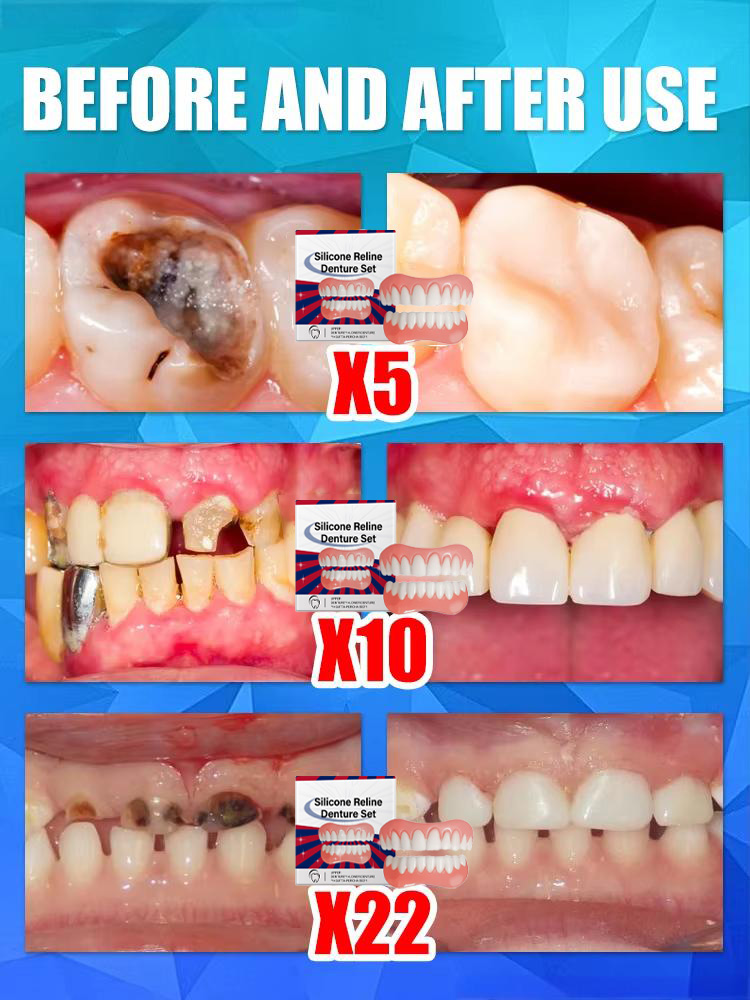 False Teeth Silicone Upper Low - Teeth Whitening With Braces review and price