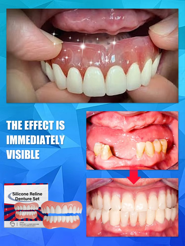 False Teeth Silicone Upper Low - Teeth Whitening With Braces review and price