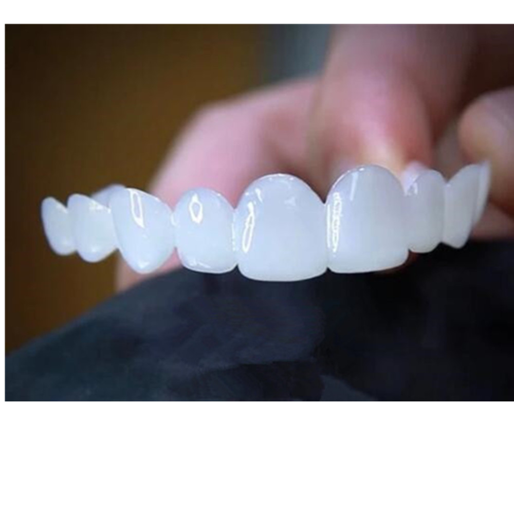 Whitening Teeth Veneers Tempor - Teeth Whitening With Braces review and price