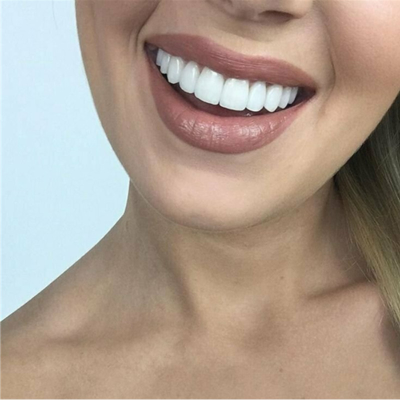 Whitening Teeth Veneers Tempor - Teeth Whitening With Braces review and price