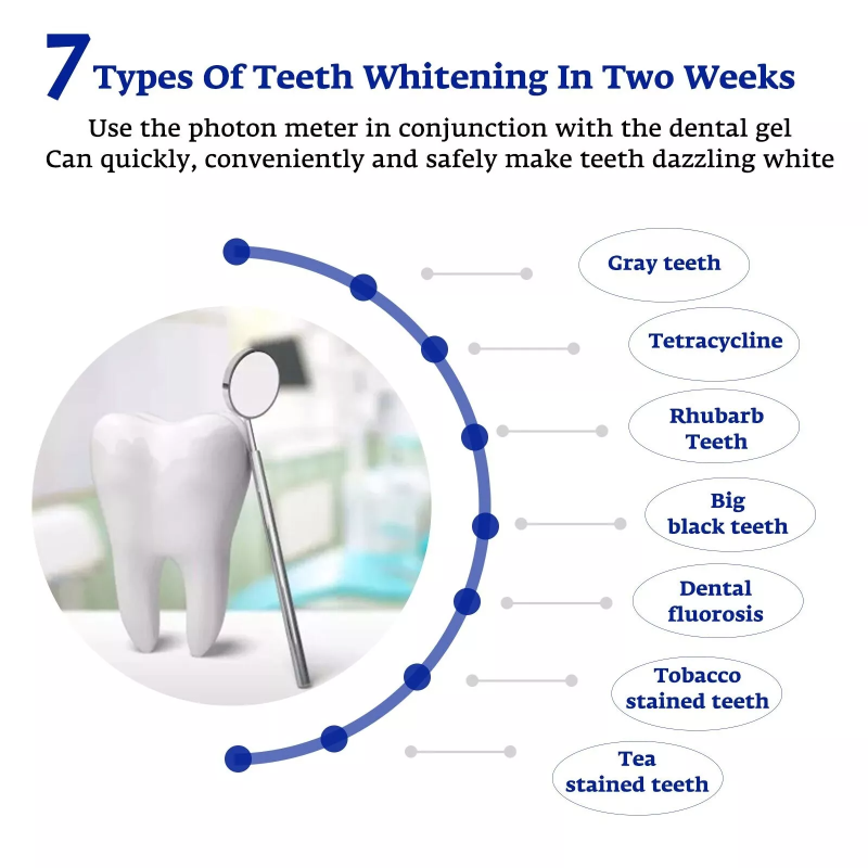 Teeth Whitening Accelerator Sm - Teeth Whitening With Blue Light review and price