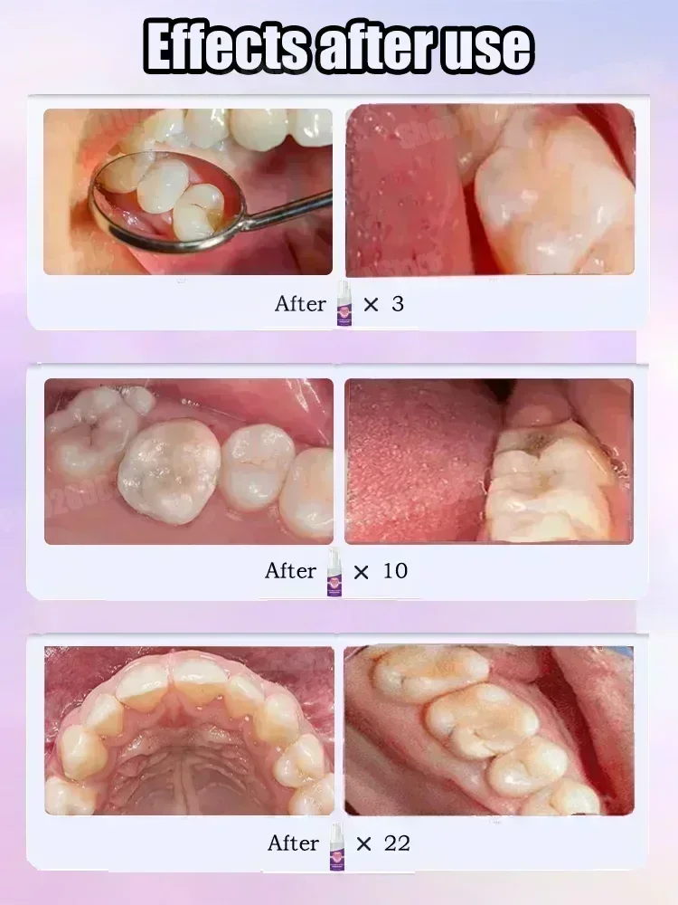 Teeth Cleaning Toothpaste Remo - Teeth Whitening Cream review and price